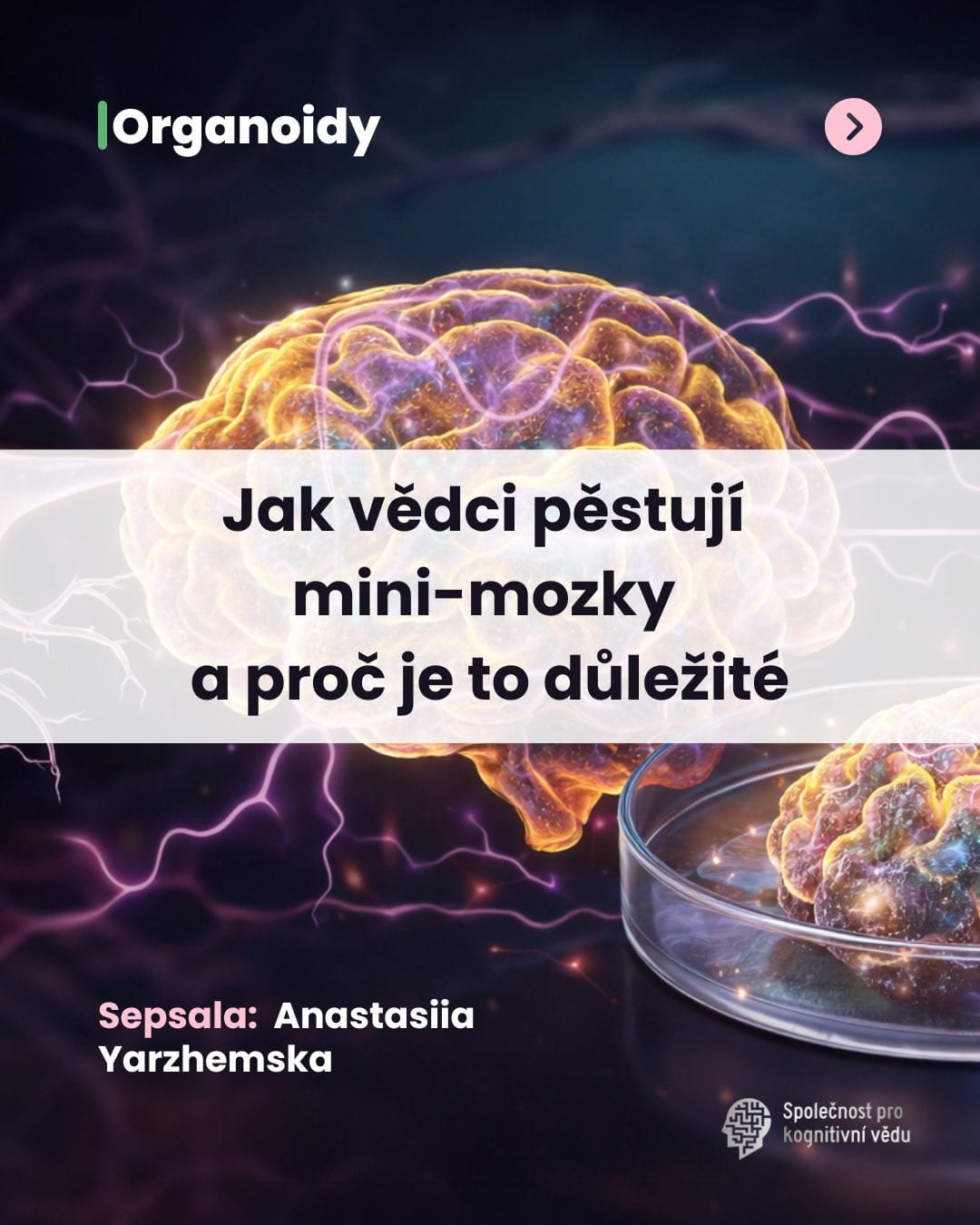 Jak vědci pěstují mini-mozky a proč je to důležité