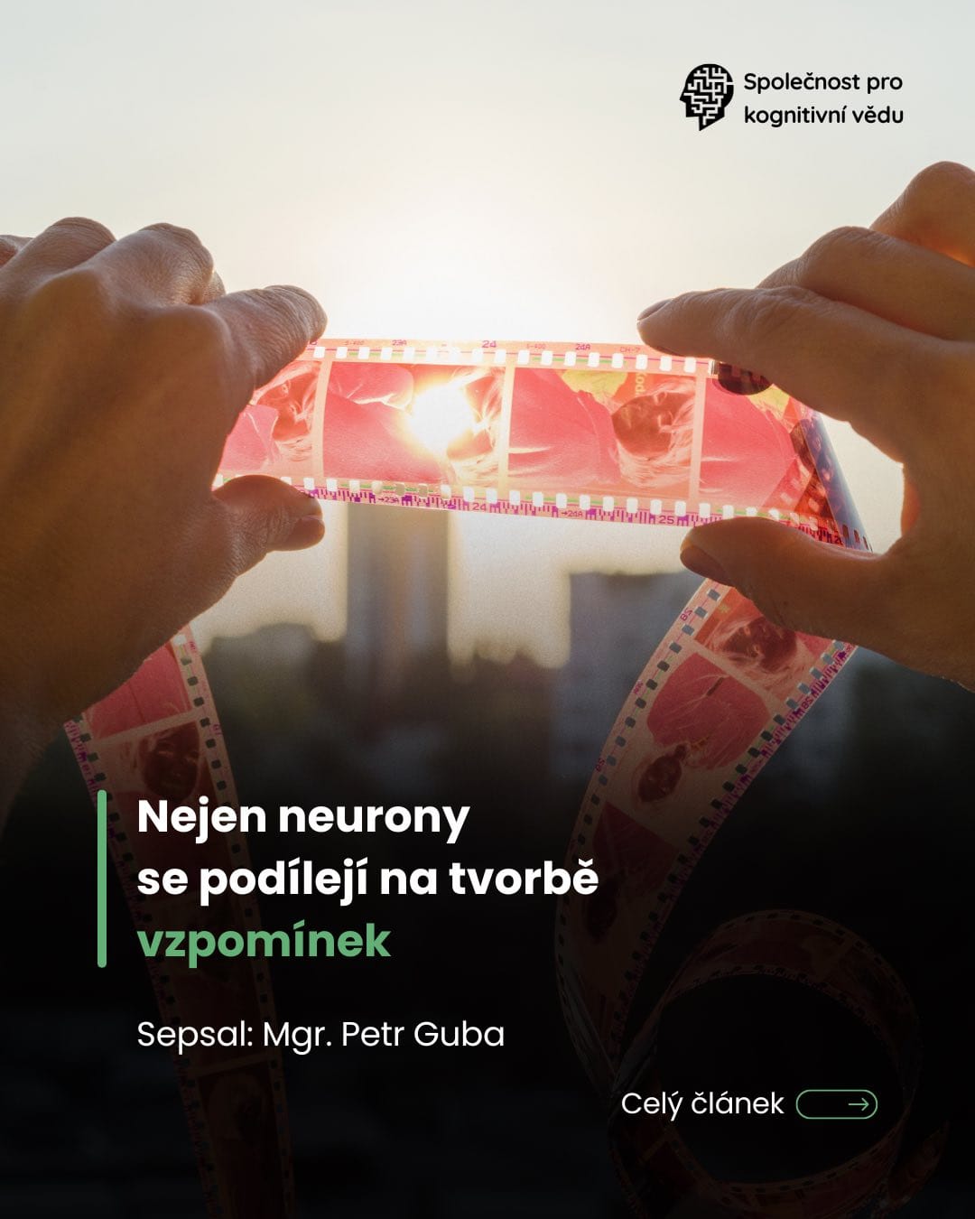 Nejen neurony se podílejí na tvorbě vzpomínek